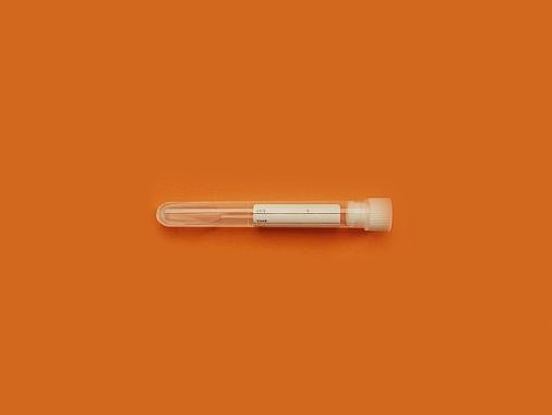 Sodyum Sitratlı Tüp, 0.4 ml, 16x60 mm