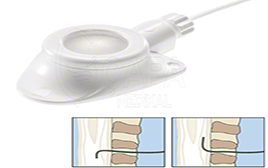 CELSITE ST304-19 EPOXY/SPINAL